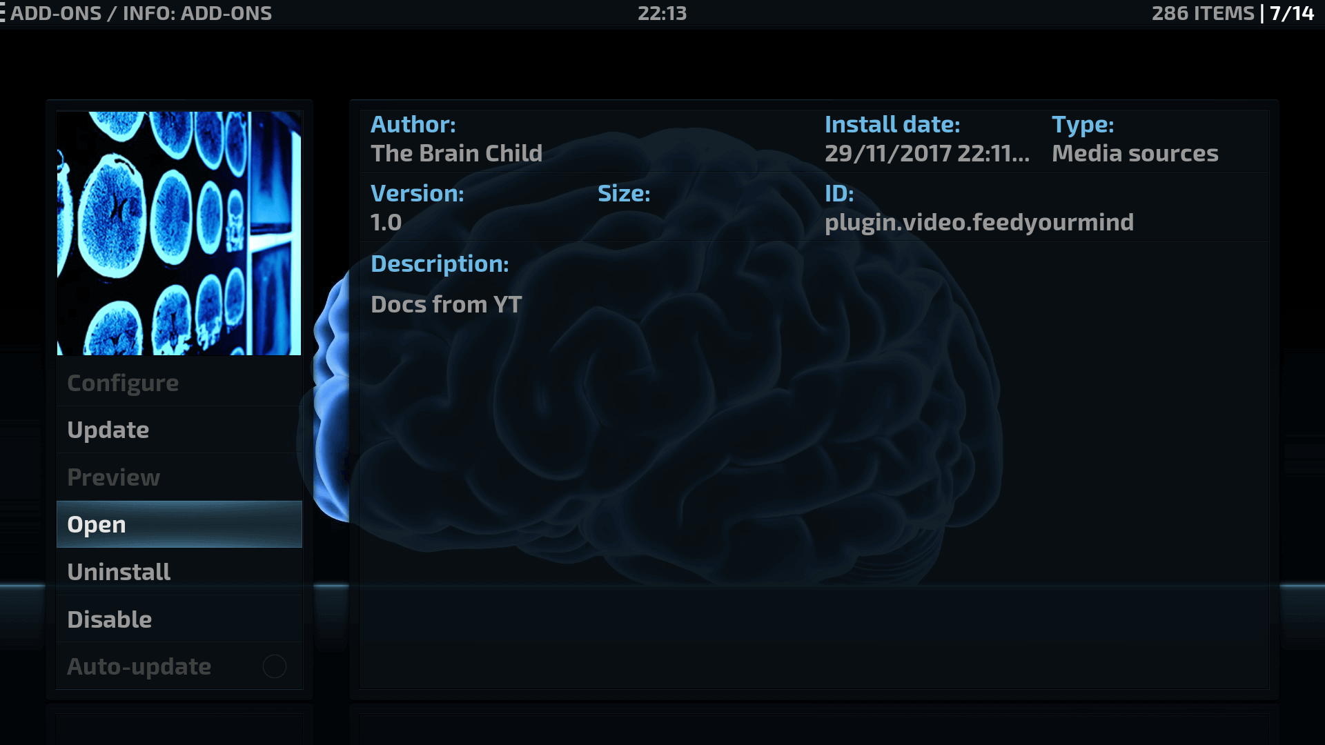 How to Install Feed your Mind Kodi addon on Krypton
